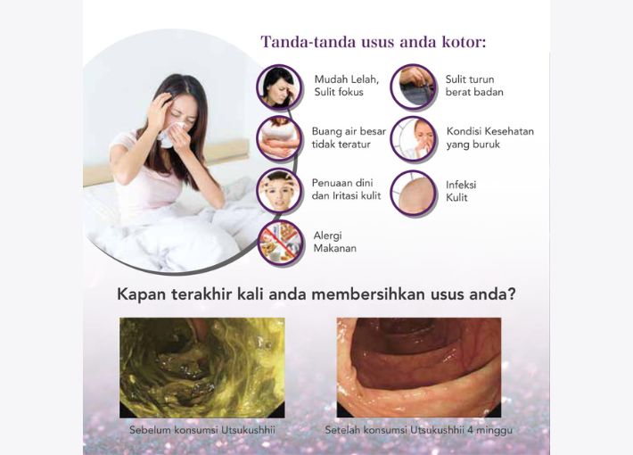 Detox Usus Kotor Alami | 081243635619