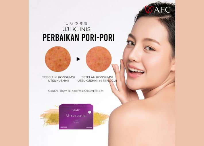 Manfaat Utsukushhii untuk Kulit | 081243635619