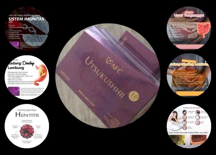 Utsukushhii Obat Untuk Apa | 081243635619